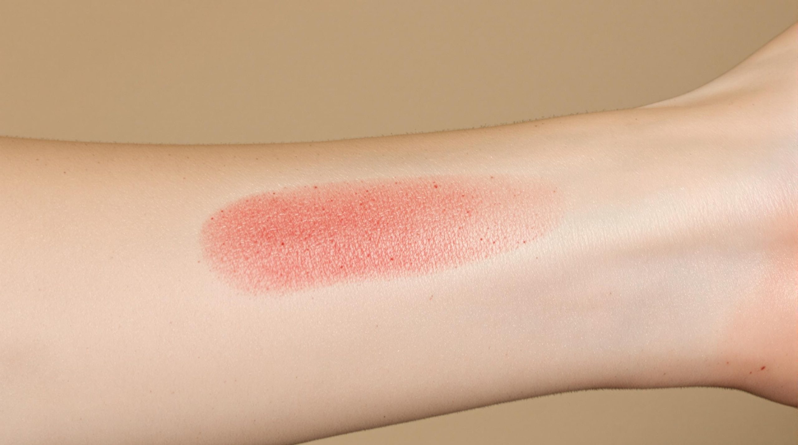 Cicatrice rouge : que faire ?